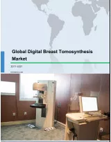 Global Digital Breast Tomosynthesis Market 2019-2023